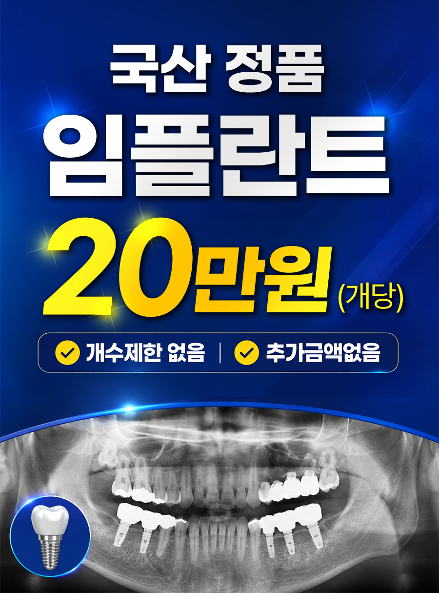 국산 정품 임플란트 20만원(개당) - 개수제한 없음, 추가금액 없음